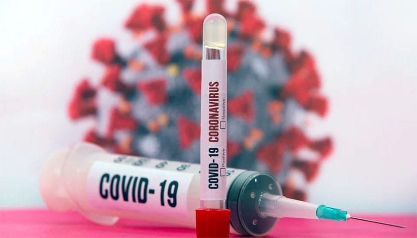 covid 19 test